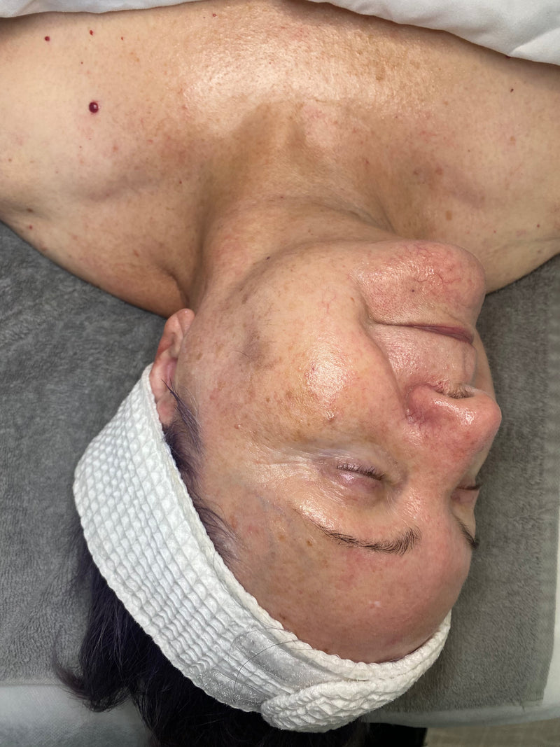 Person with white headband lying on a gray towel on the spa bed